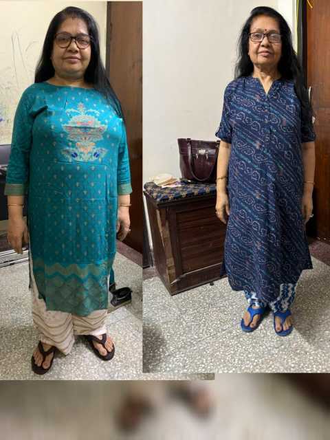 Transformation 15