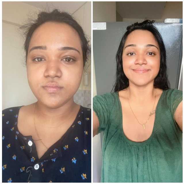 Transformation 36